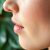 Co powinieneś wiedzieć o dermatologu i chorobach skóry?