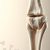 Osteoporoza – przyczyny, objawy, leczenie i profilaktyka